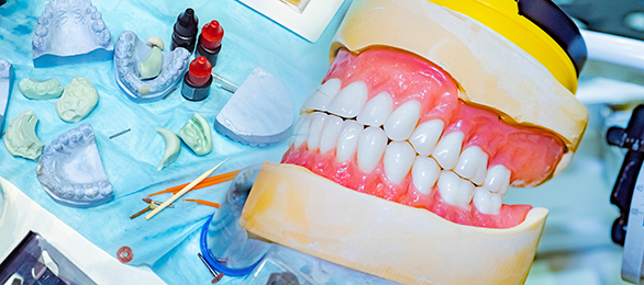 prodenco-dental-labs-custom-restorations custom dental restorations