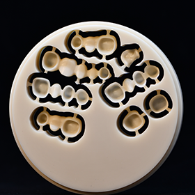 prodenco-dental-labs-fixed-restorations-quality Prodenco Dental Labs Fixed Restoration Product