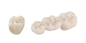 prodenco-dental-labs-bridge-solid-zirconia-singles-fcz Prodenco Dental Labs Solid Zirconia Single and bridge